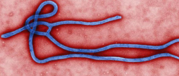 Ebola virus raises concern for U.S.
