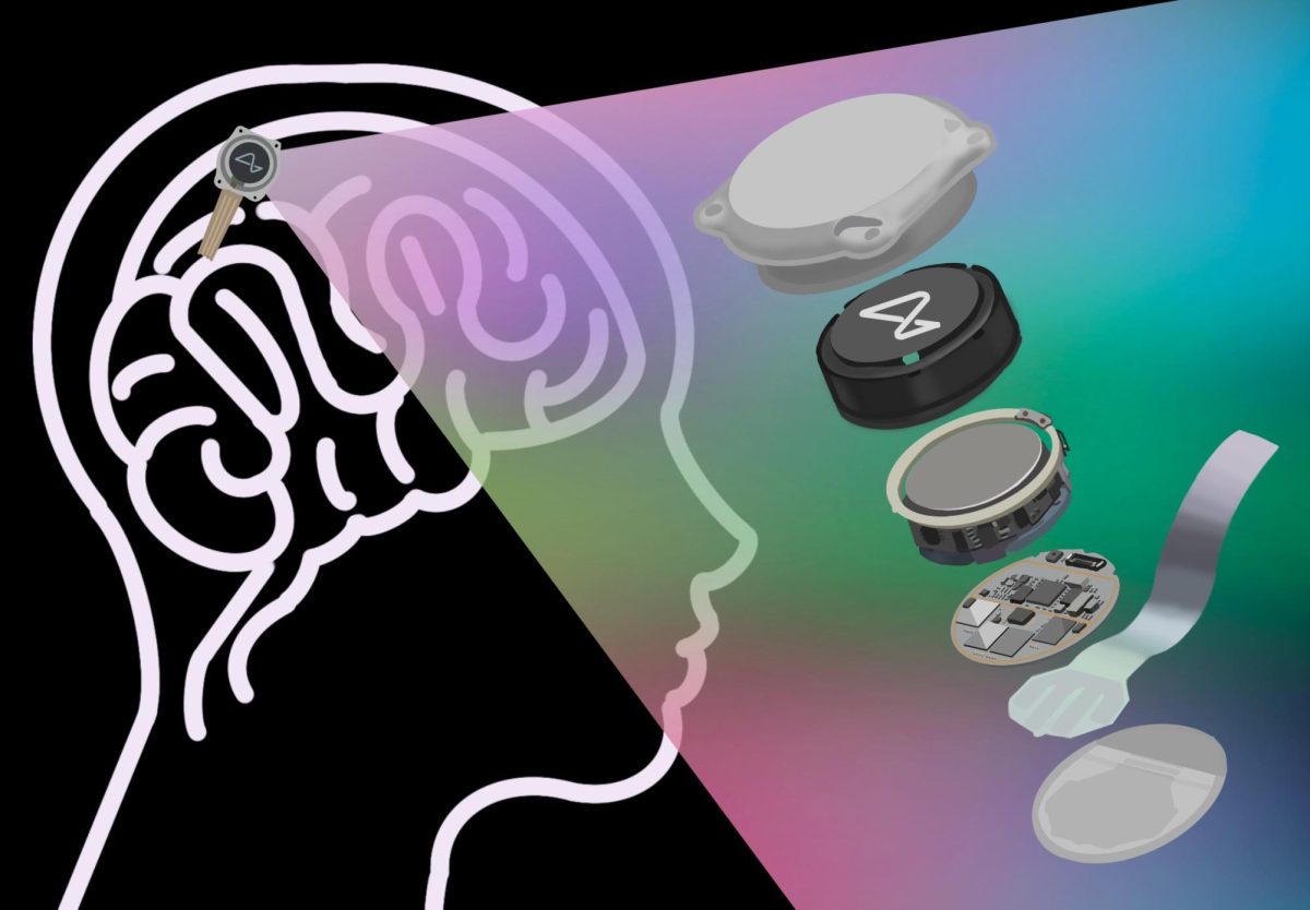 The breakdown: Getting a closer look, a graphic shows the six components that comprise the Neuralink chip. The chip is implanted via a surgical robot instead of a human hand.